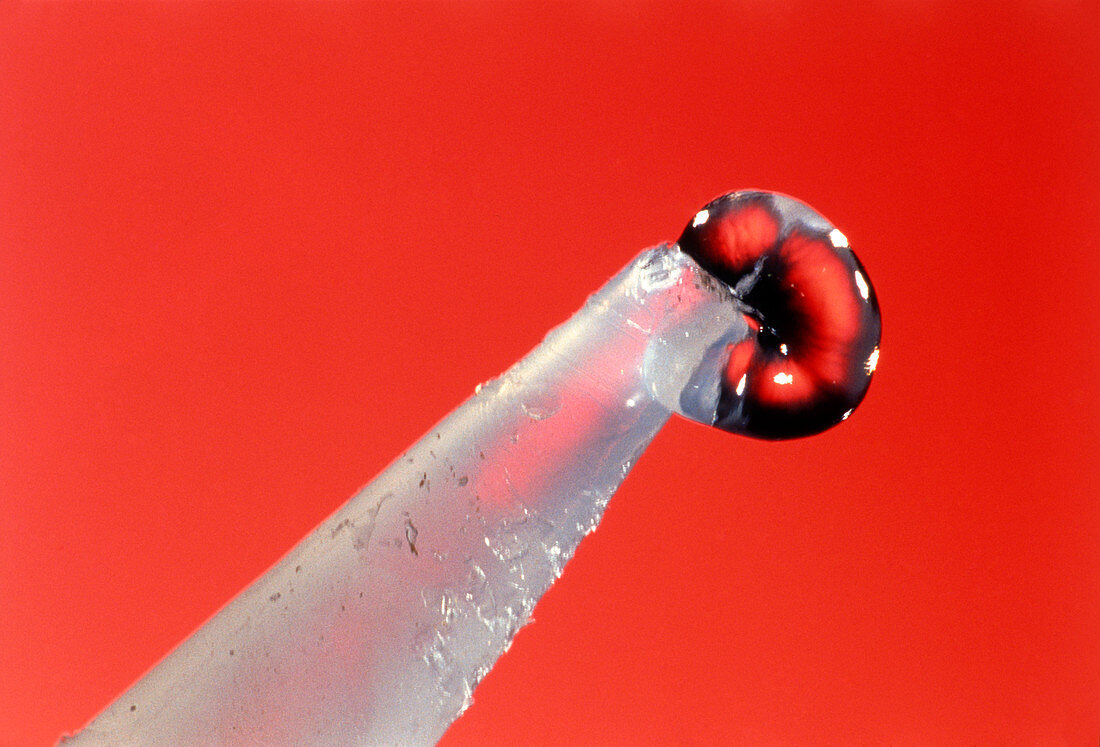 A drop of superglue on the tip of a dispenser