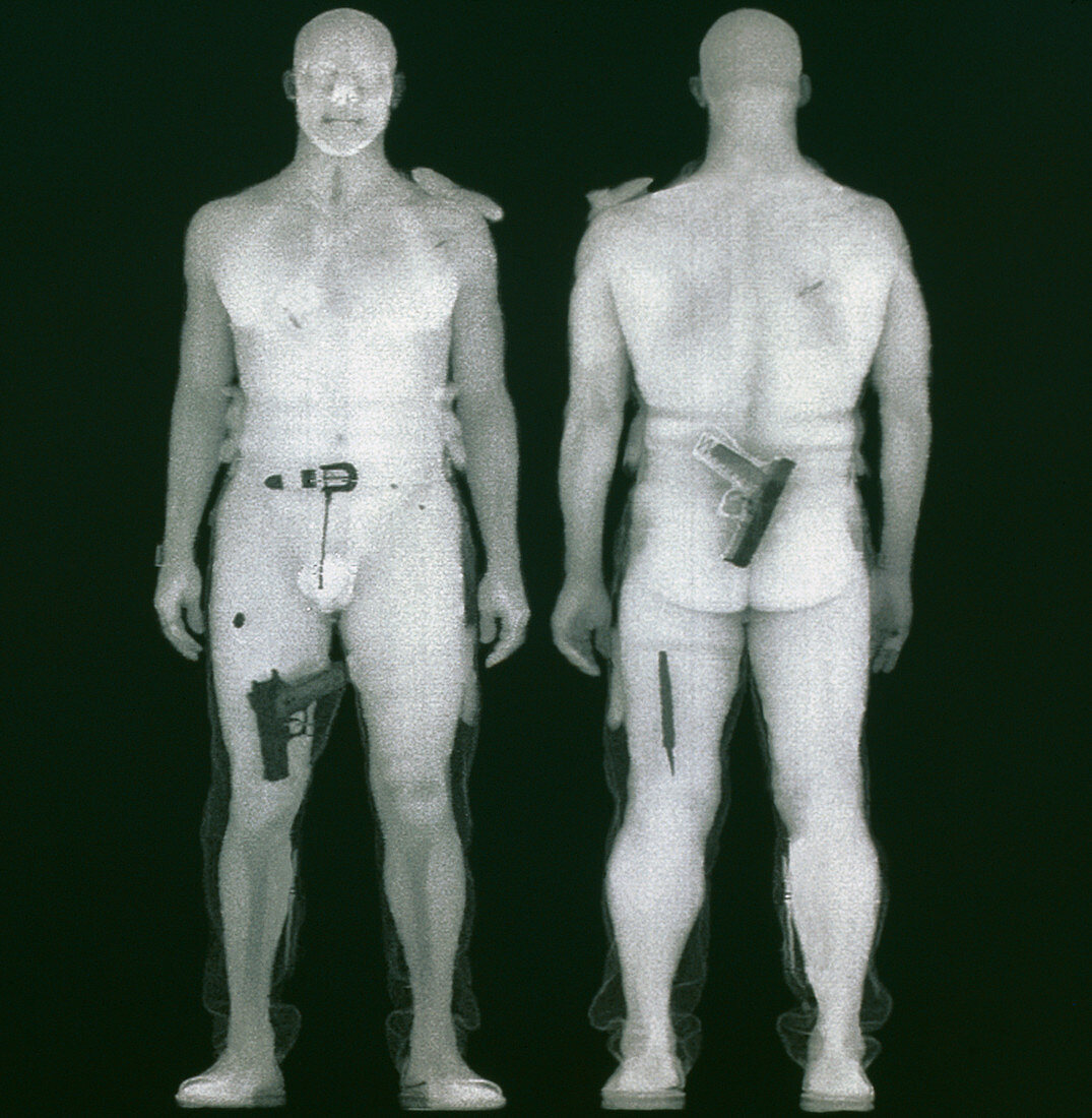 X-ray of man from BodySearch surveillance