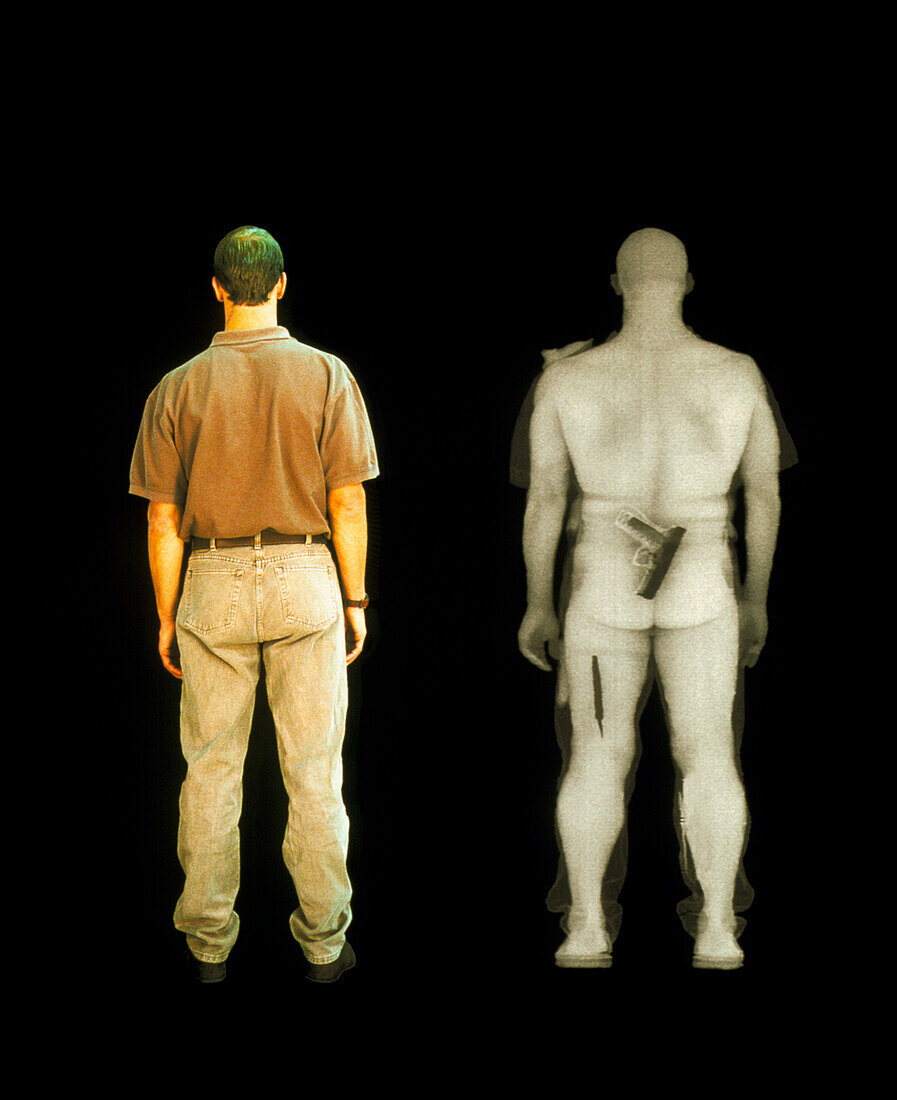 X-ray during BodySearch surveillance