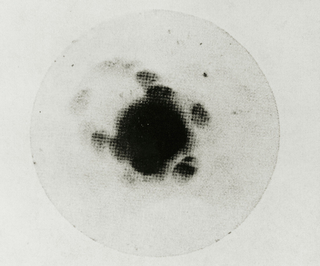 The first X-ray crystal diffraction photo