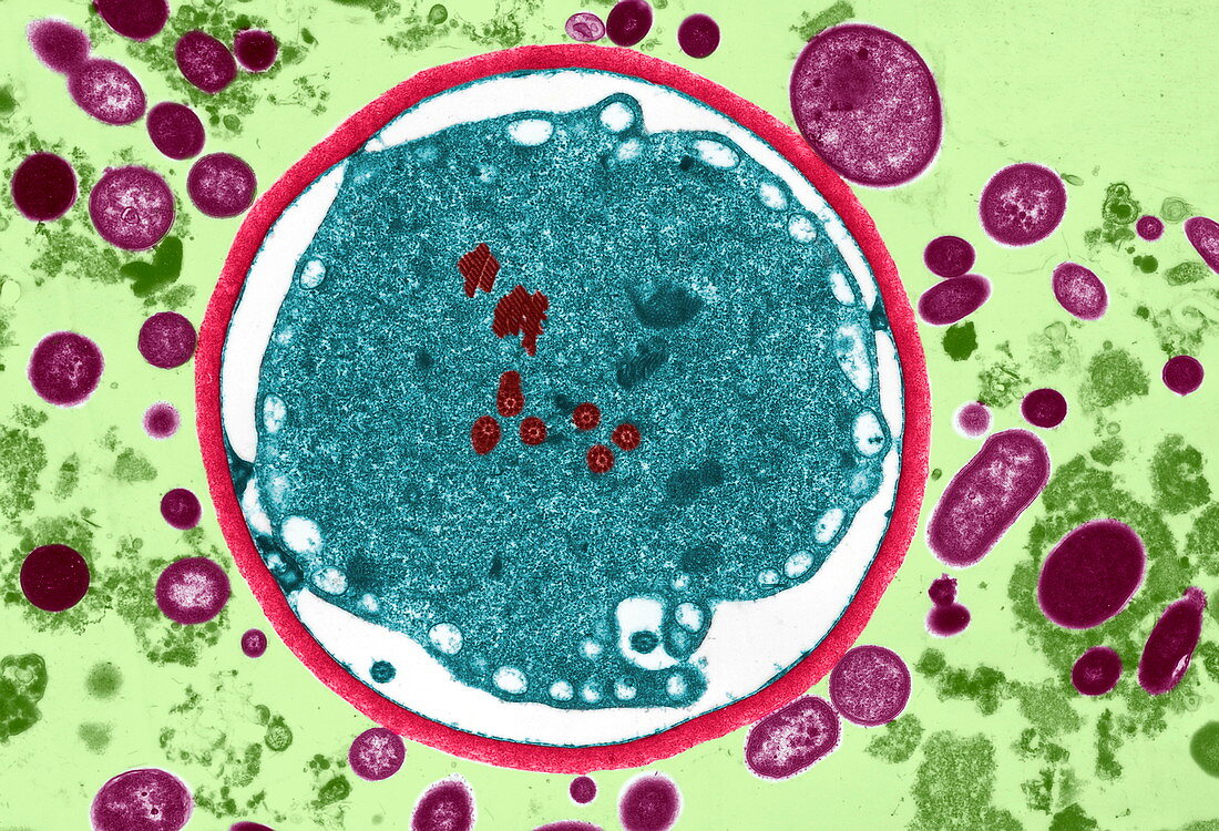 Giardia lamblia protozoan,TEM