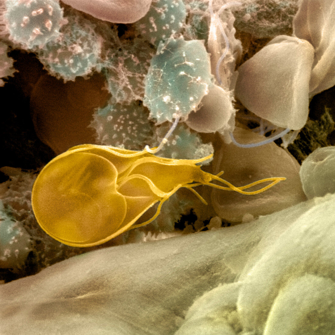 Giardia lamblia protozoan,SEM