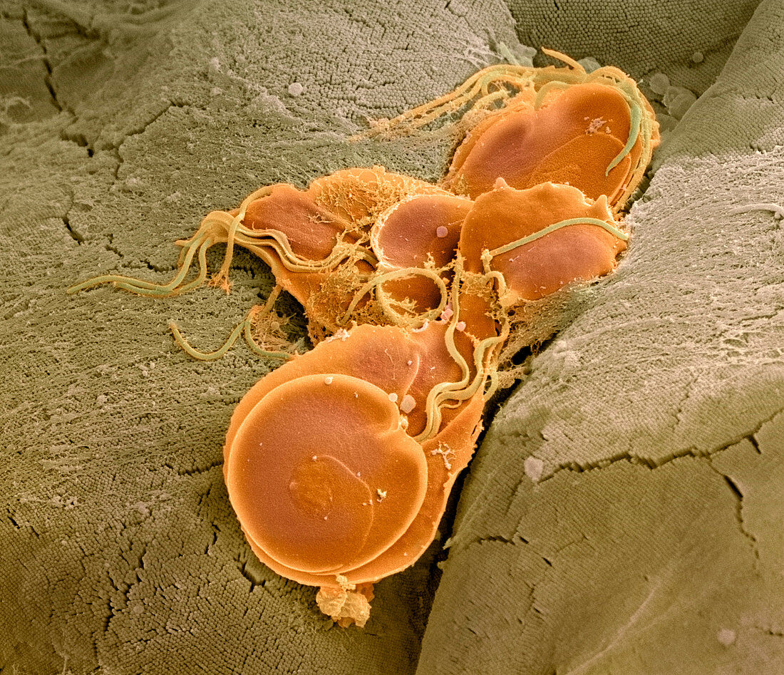 Giardia lamblia protozoa,SEM