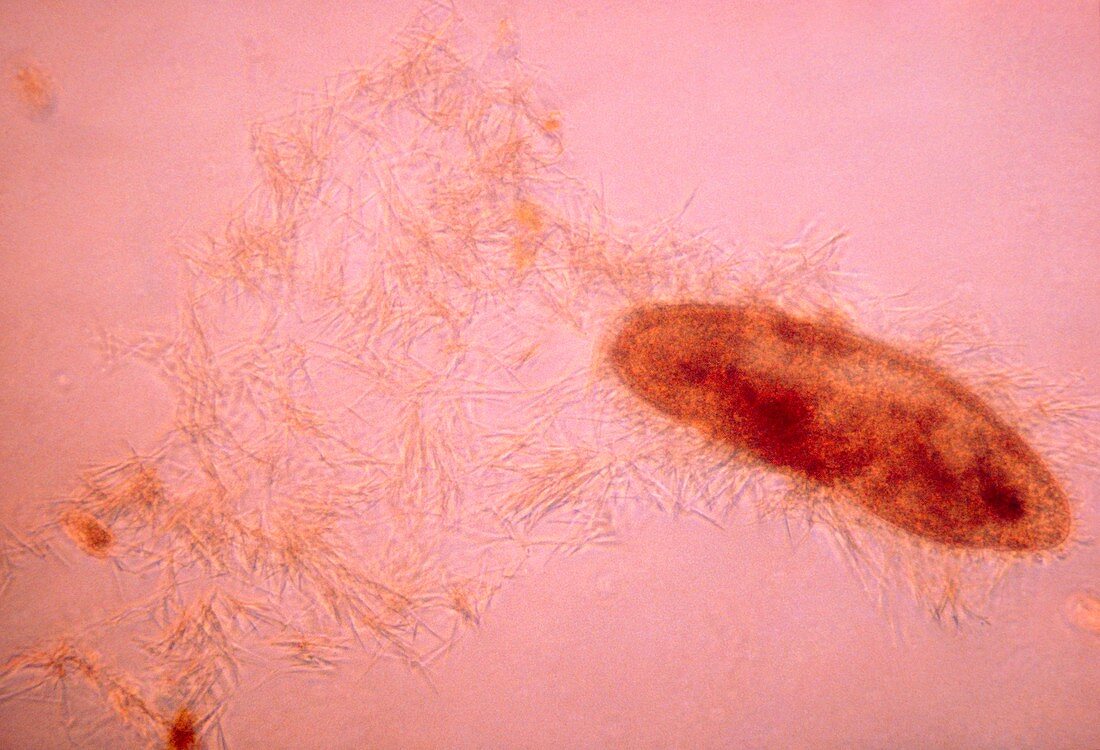LM of Paramecium caudatum,a ciliate protozoan