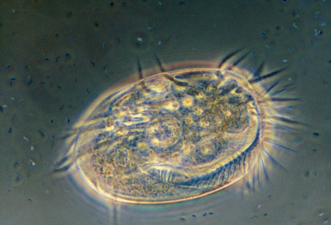 Light micrograph of Euplotes sp