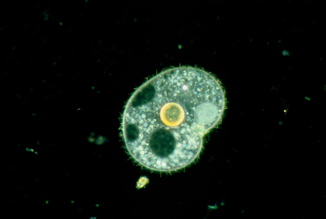 Light micrograph of a ciliate protozoan