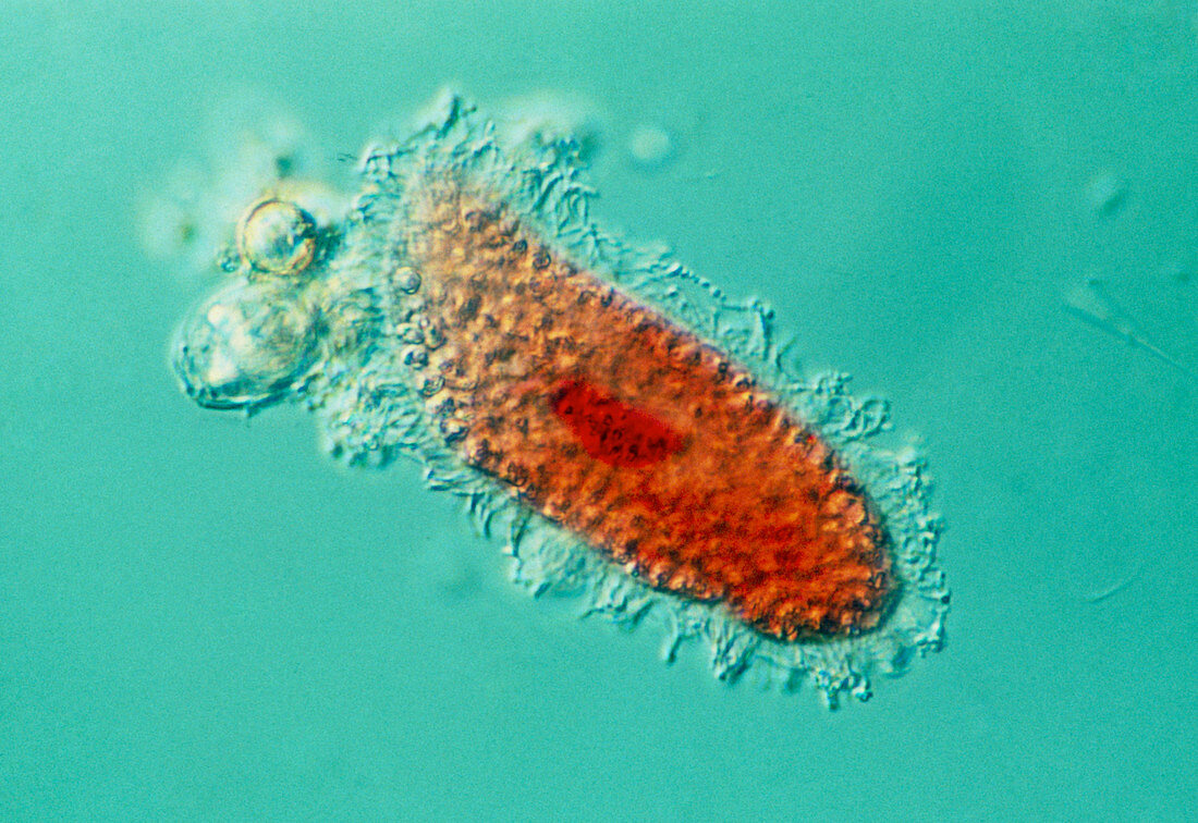 LM of Paramecium,a freshwater protozoan