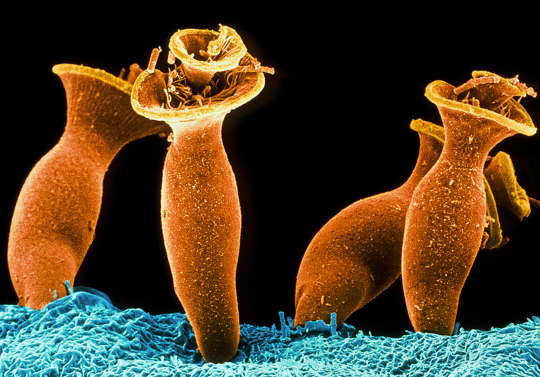 Spirochona protozoa