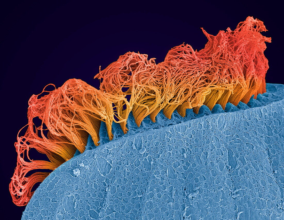 Ciliate protozoan,SEM