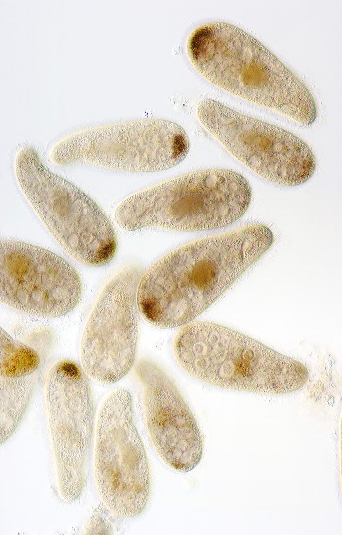 Chilodonella ciliate protozoa,LM