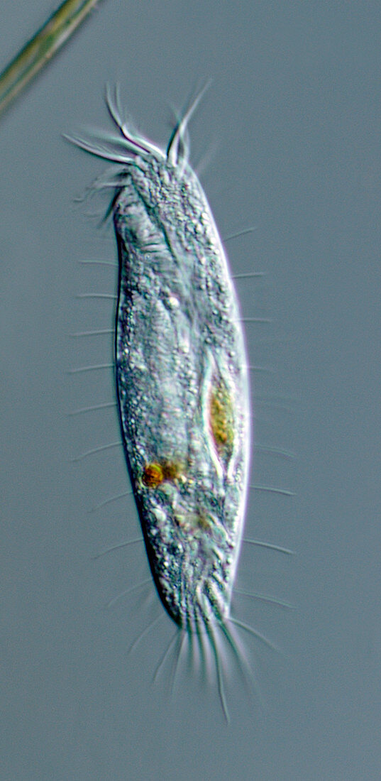 Balladyna ciliate protozoan