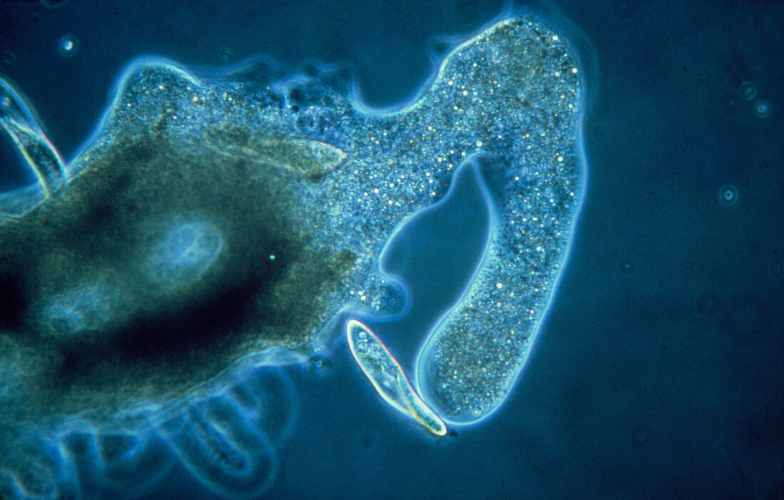 LM of an amoeba engulfing a paramecium