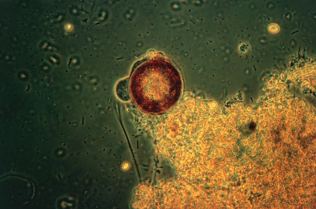 LM of a shelled amoeba protozoan,Arcella sp