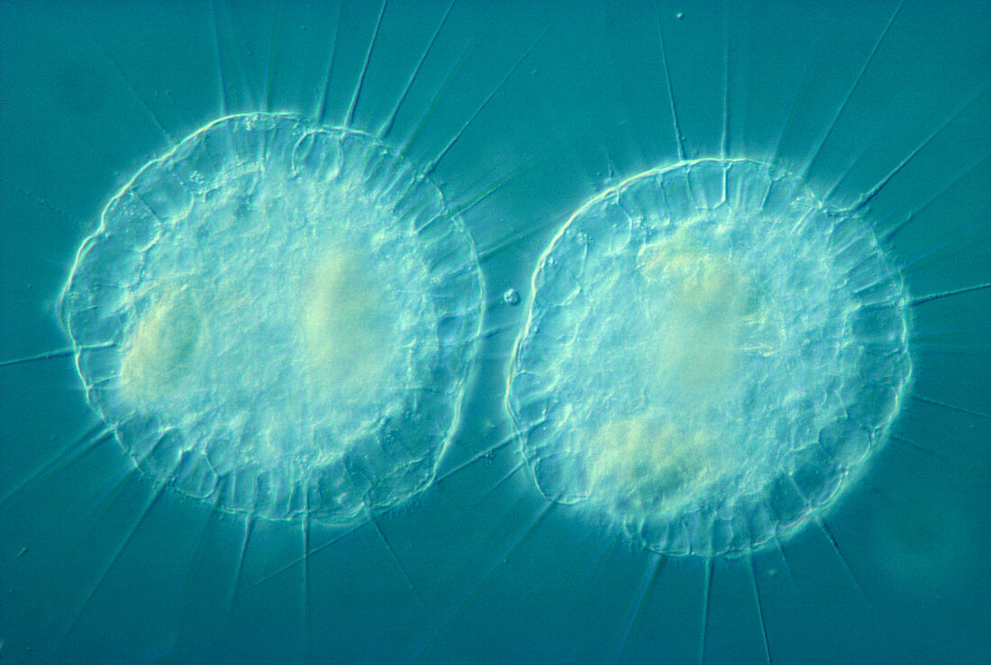 Light micrograph of protozoa Echinosphaer