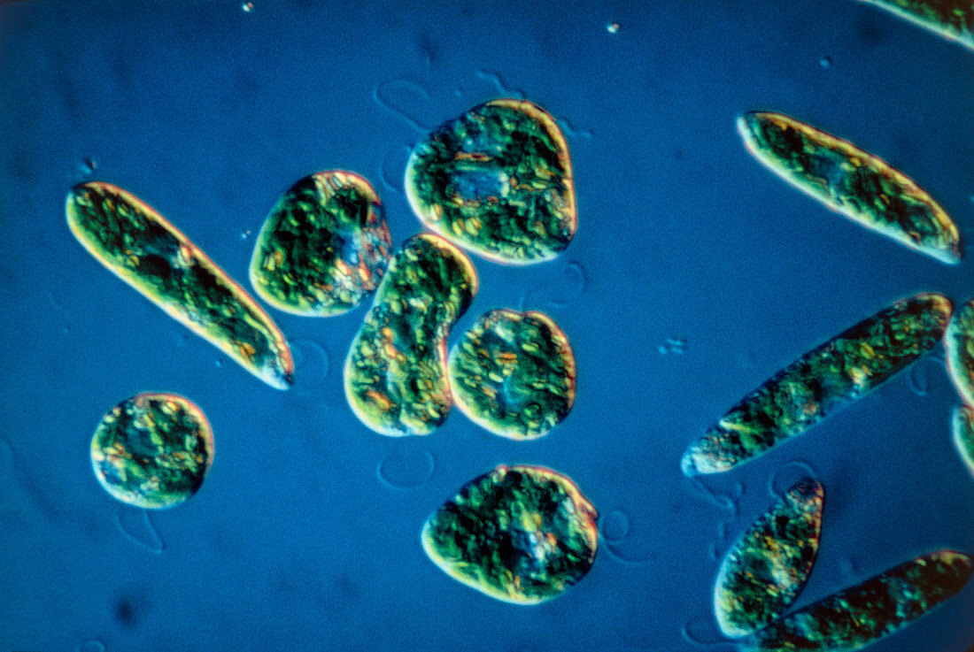 Photomicrograph of group specimens of Eugelna sp