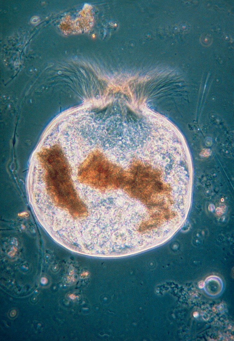 LM of flagellate protozoan Barbulanympha ufalula