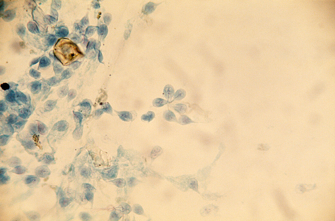Giardia sp. parasites