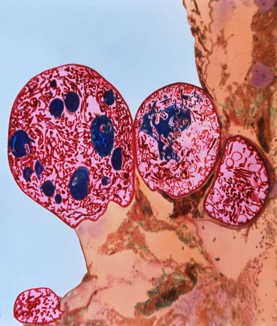 TEM malaria oocysts in mosquito stomach