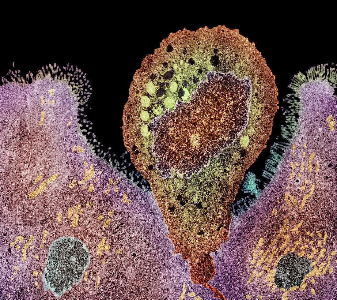 Enterocytozoon sp. parasite,coloured TEM
