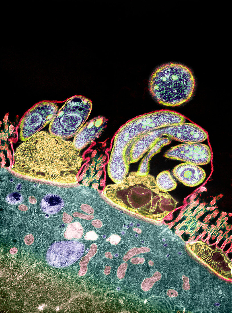 Intestinal protozoan parasites,TEM
