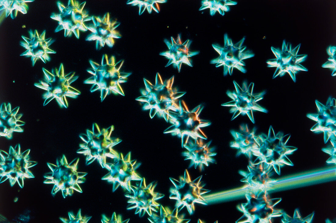 Light micrograph of sponge spicules
