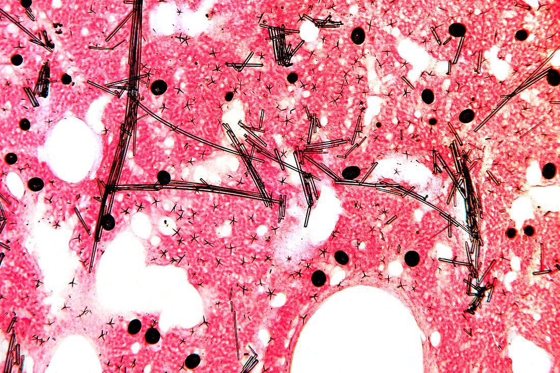 Sponge tissue,light micrograph
