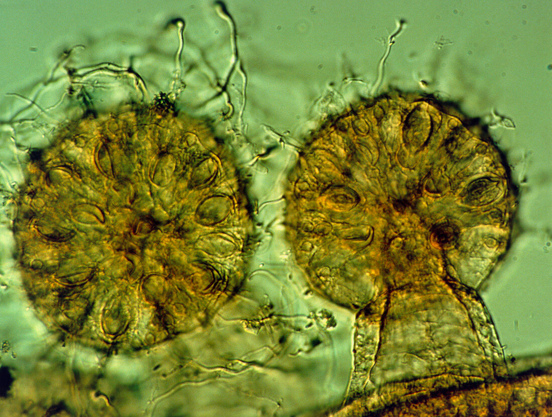 LM of tentacles of a colonial hydroid,Obelia sp