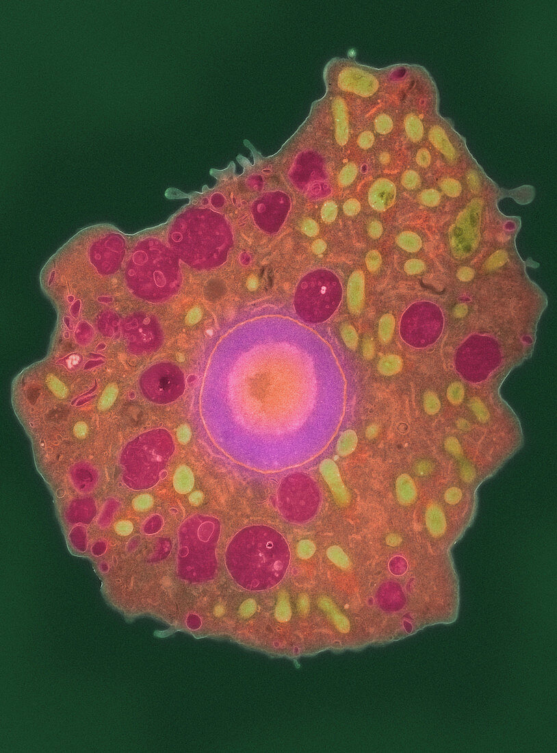 Naegleria fowleri protozoa,TEM