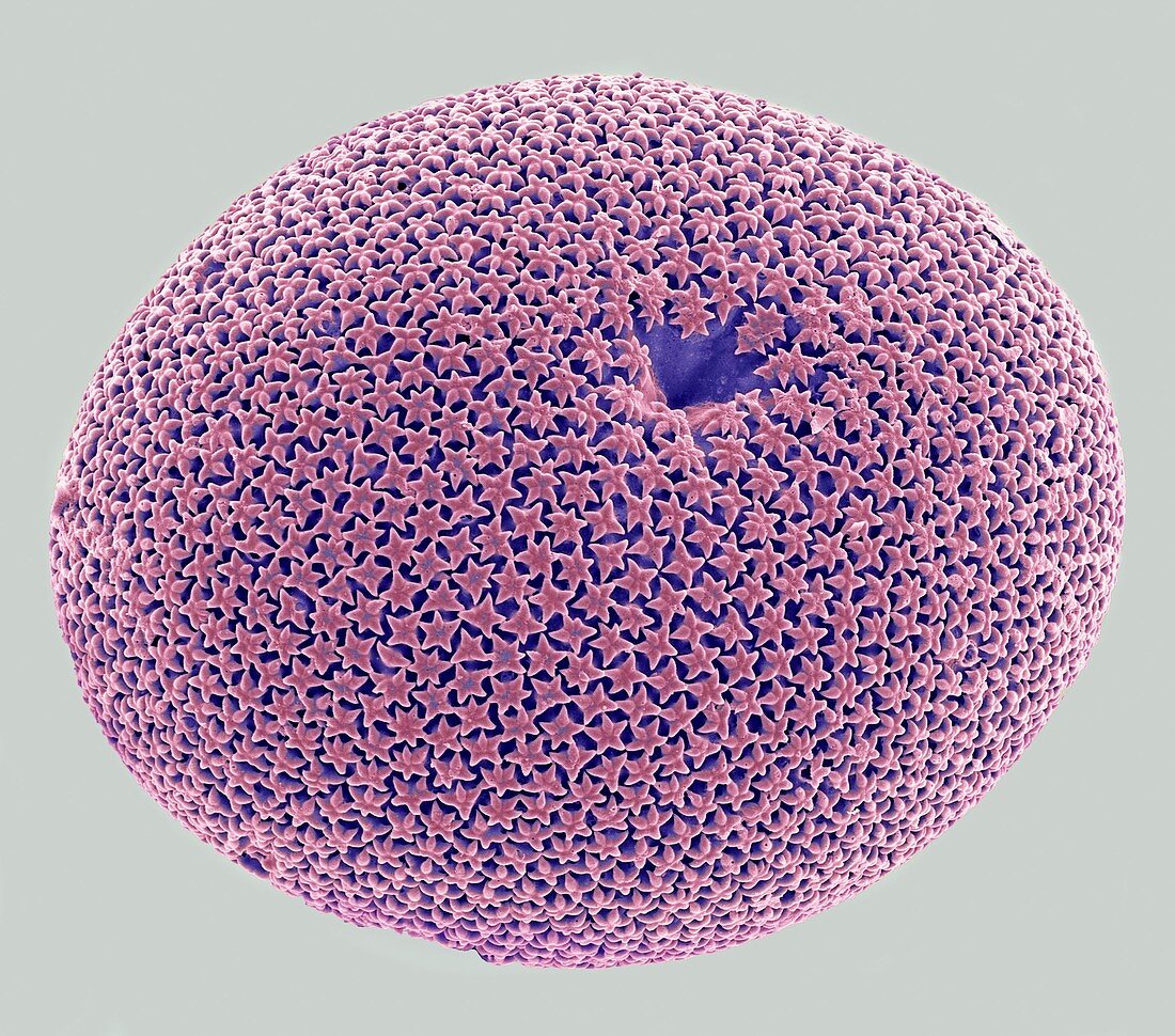 Orbulina foraminiferan,SEM