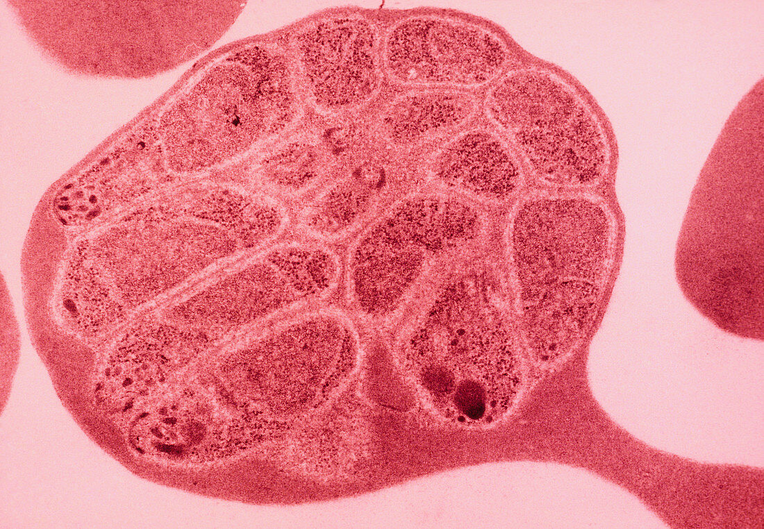 Tinted TEM of Malaria infected red blood cell