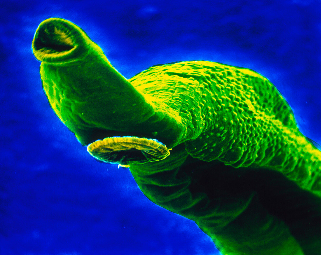 SEM of the mouth & sucker of the bilharzia fluke