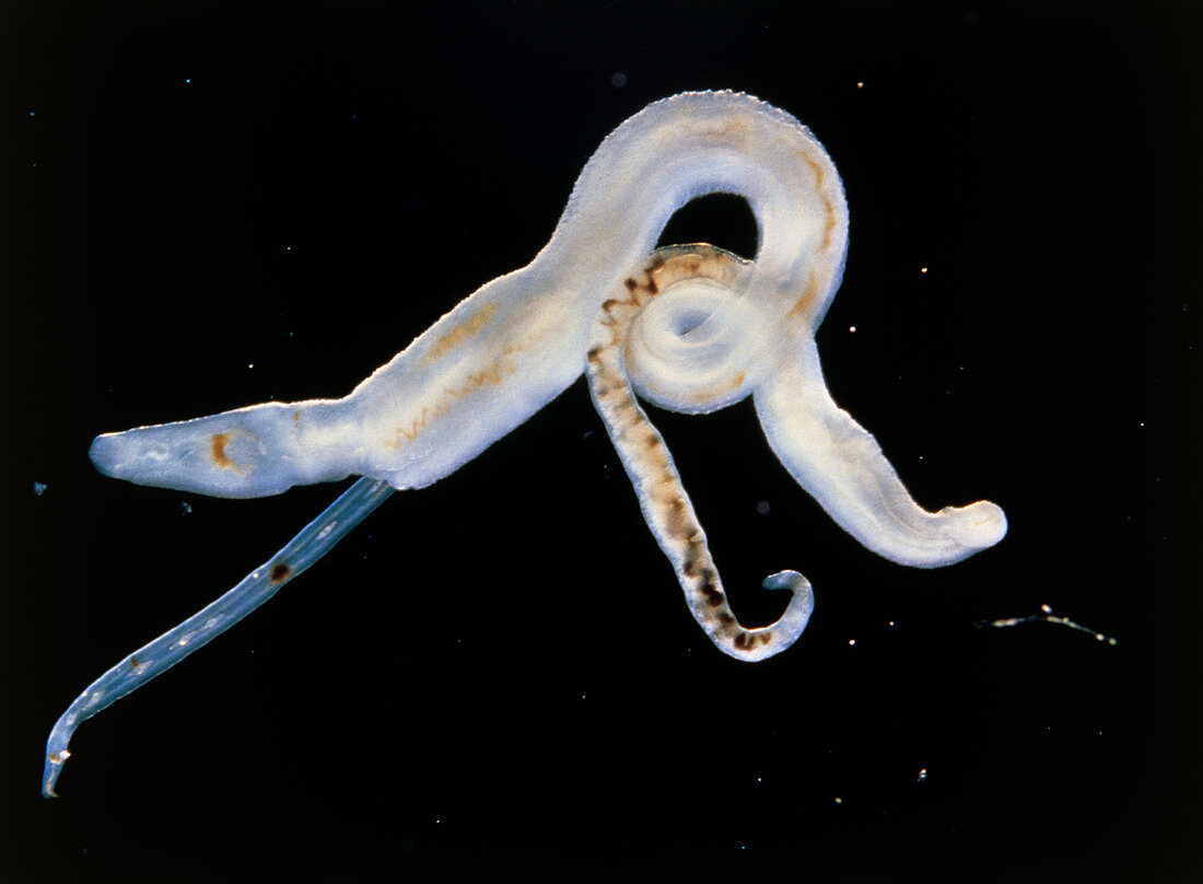 Light micrograph of male/female Schistosoma bovis