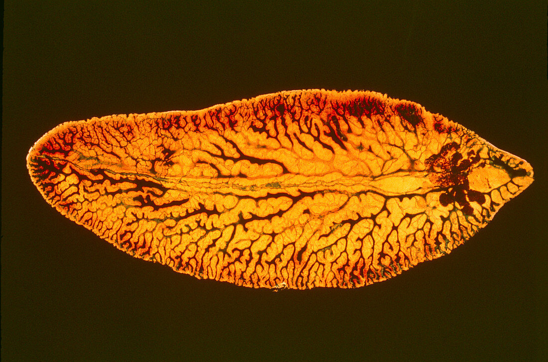Light micrograph of liver fluke,Fasciola hepatica