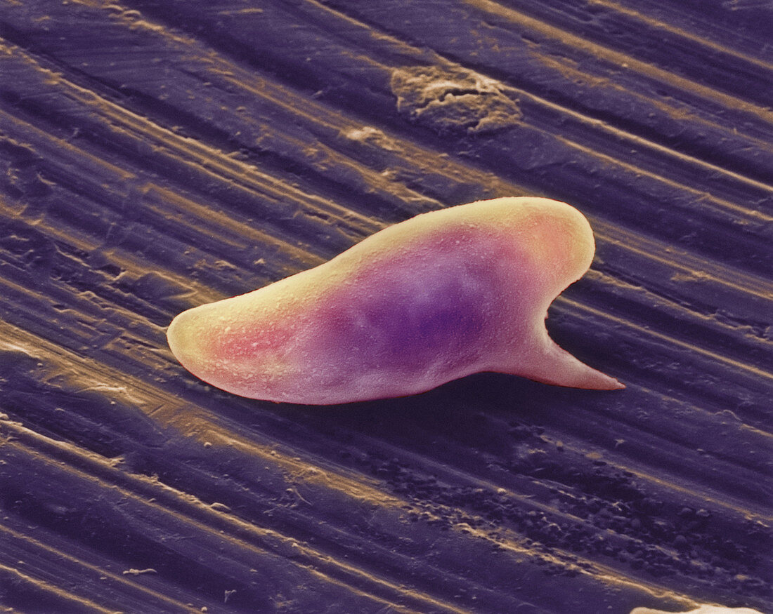 Coloured SEM of Schistosoma mansoni parasite egg