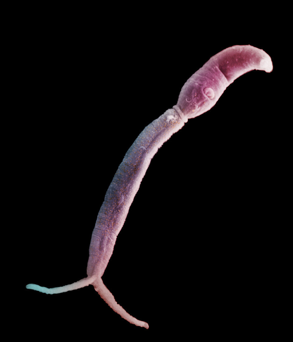 Coloured SEM of a schistosome parasite cercaria