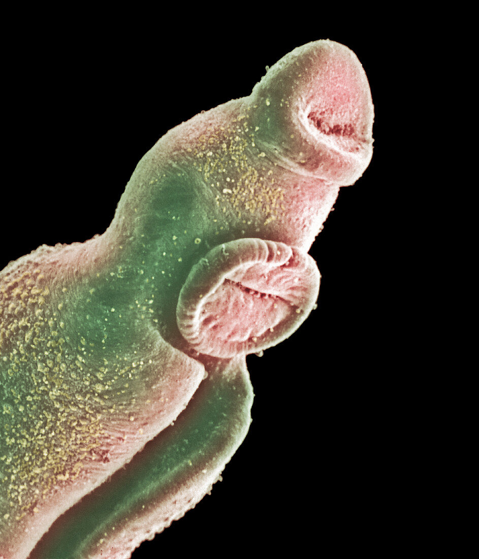 Coloured SEM of head of male schistosome parasite