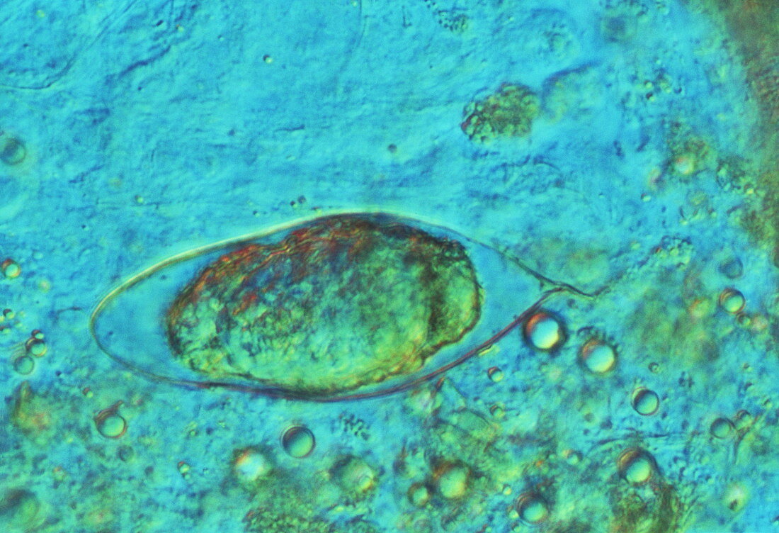 Schistosome egg