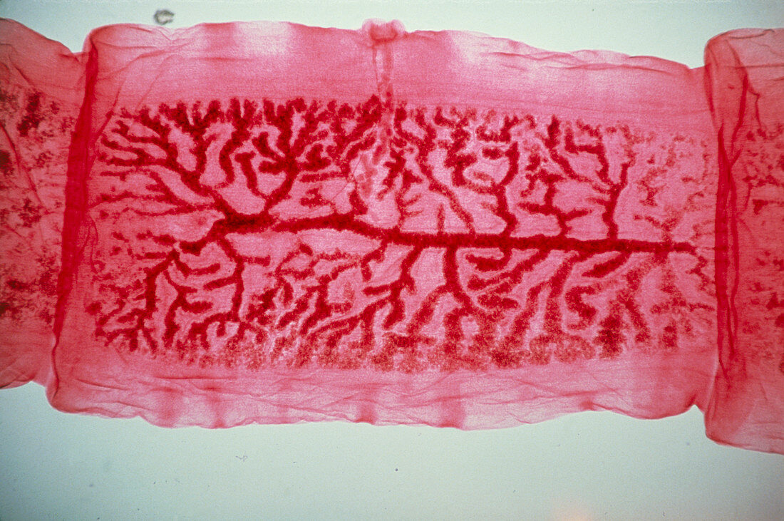 LM of a unit from the body of tapeworm,Taenia sp