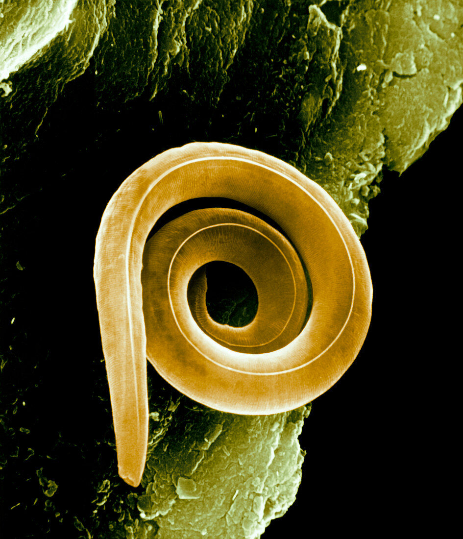 Nematode worm,SEM