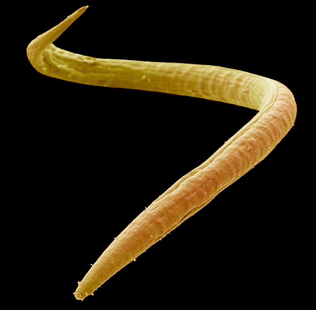 Freshwater nematode worm,SEM