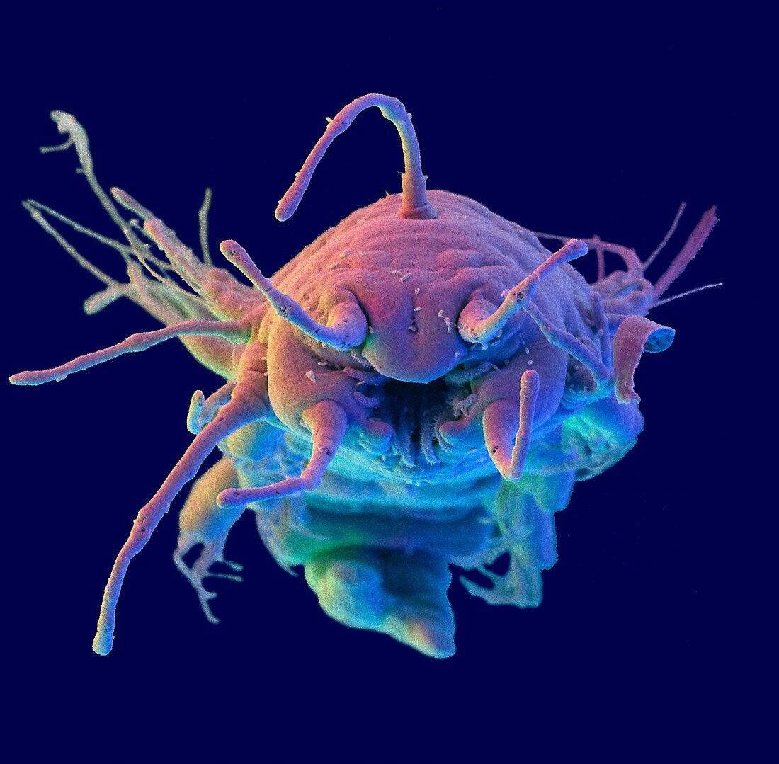 Head of sand-dwelling microscopic polychaete worm