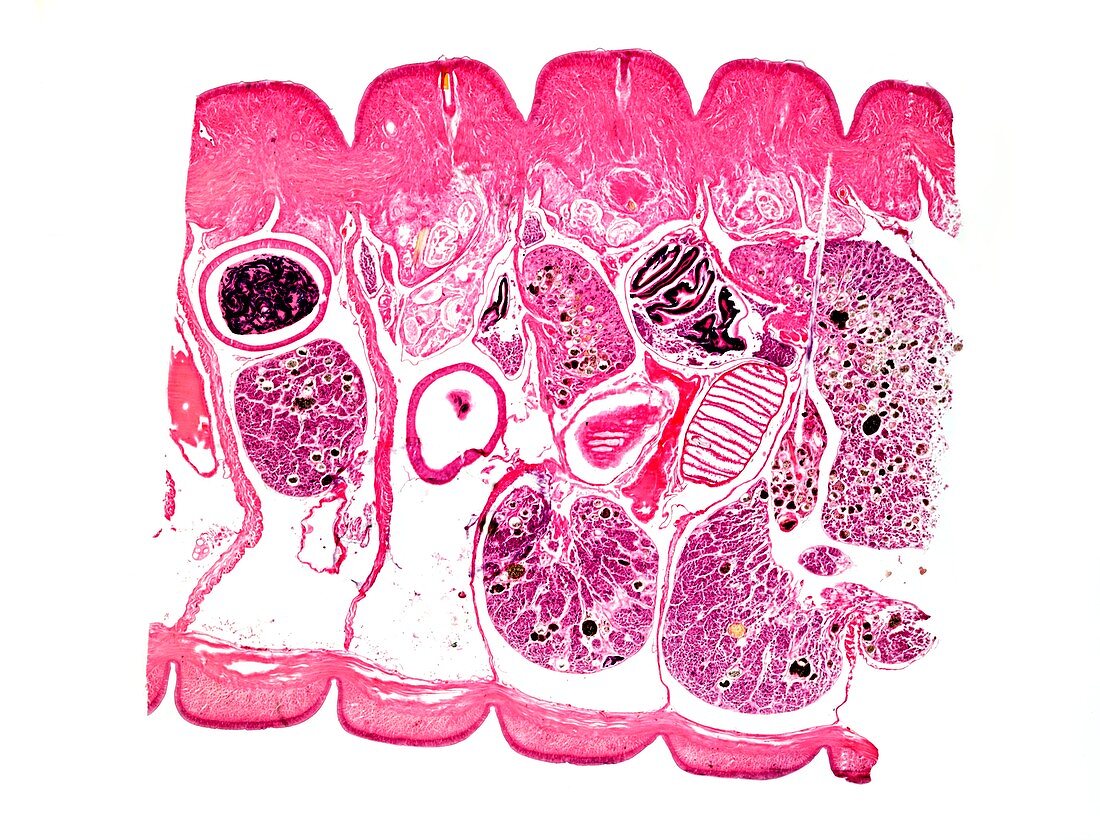 Earthworm,longitudinal section