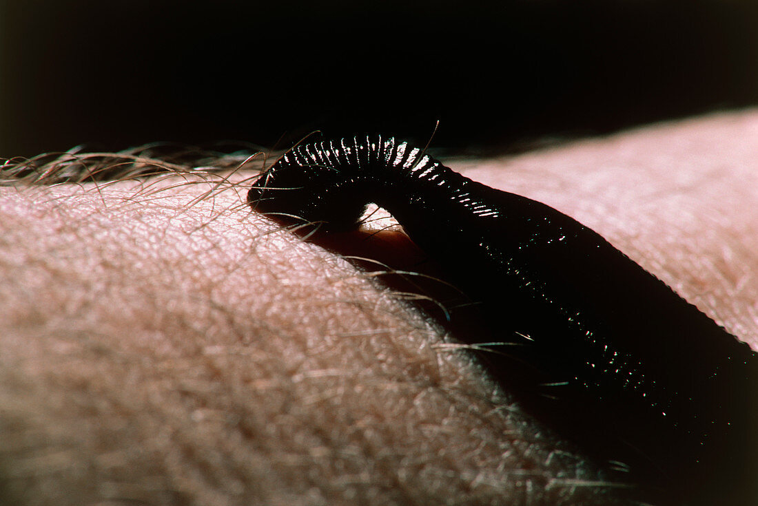 Medicinal leech sucking blood from human skin