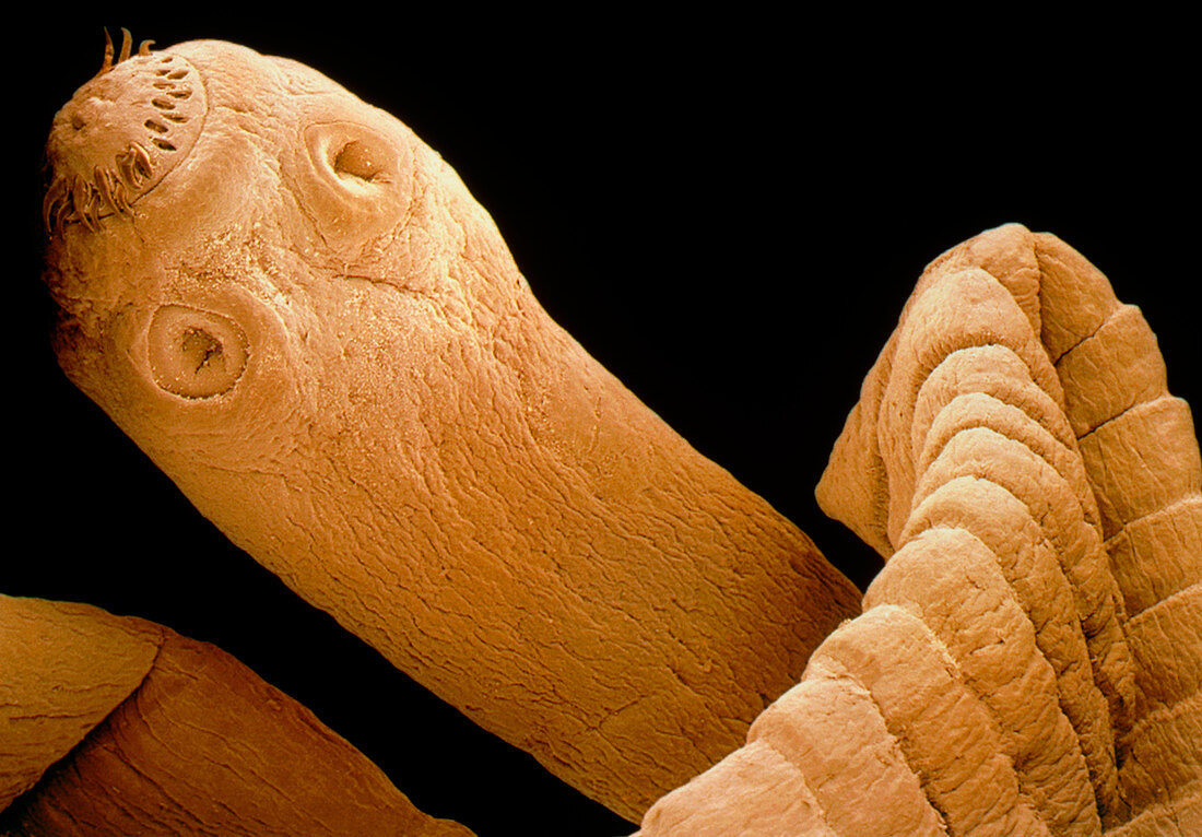 Coloured SEM of a tapeworm,Taenia sp