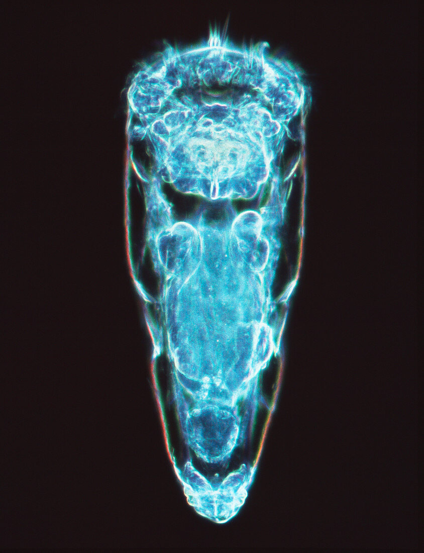 Rotifer worm,light micrograph