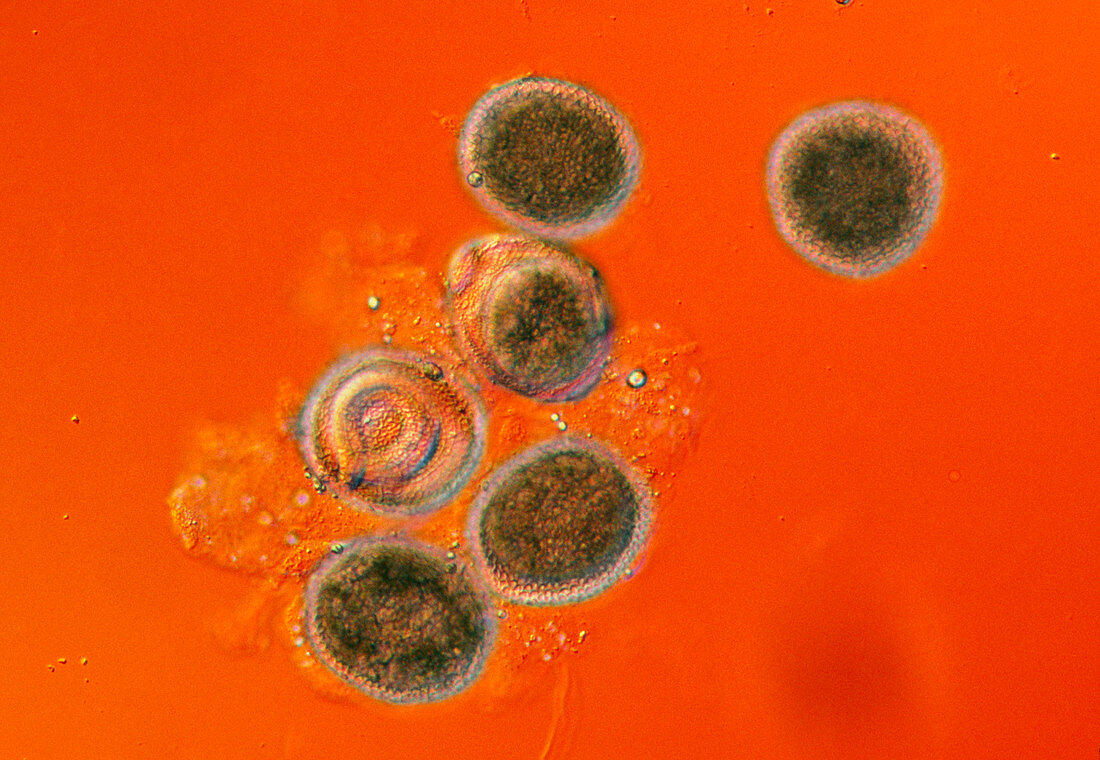 Toxocara canis,eggs x65 on orange background