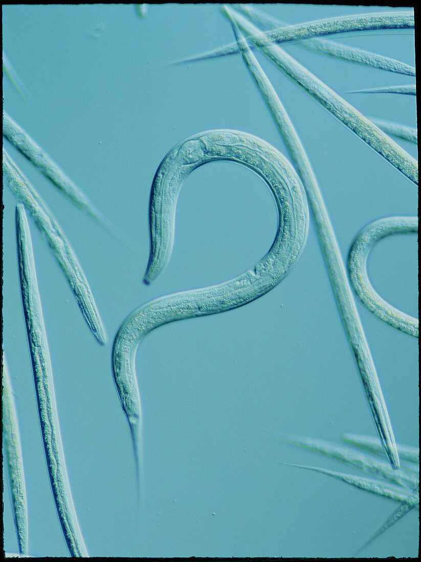 LM of the nematode worm,Caenorhabditis elegans