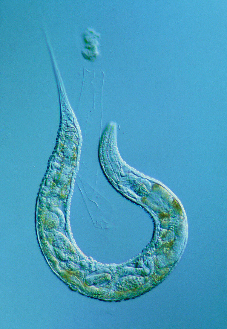 LM of the nematode worm,Caenorhabditis elegans