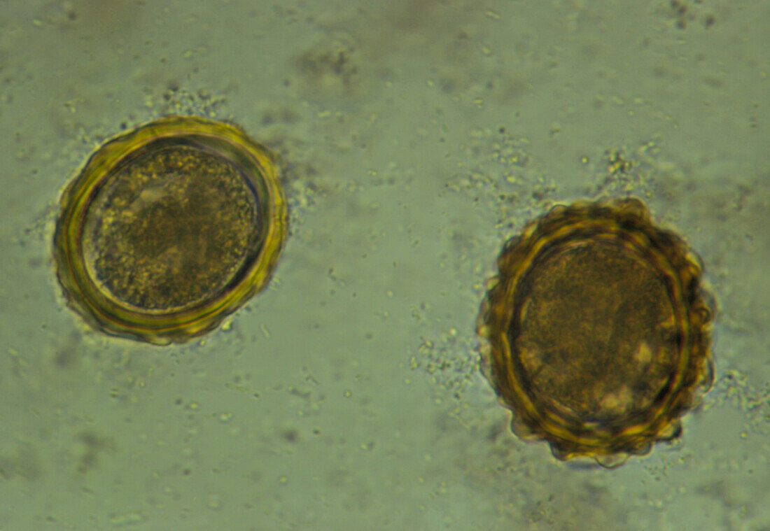 LM of eggs of the parasite,Ascaris lumbricoides