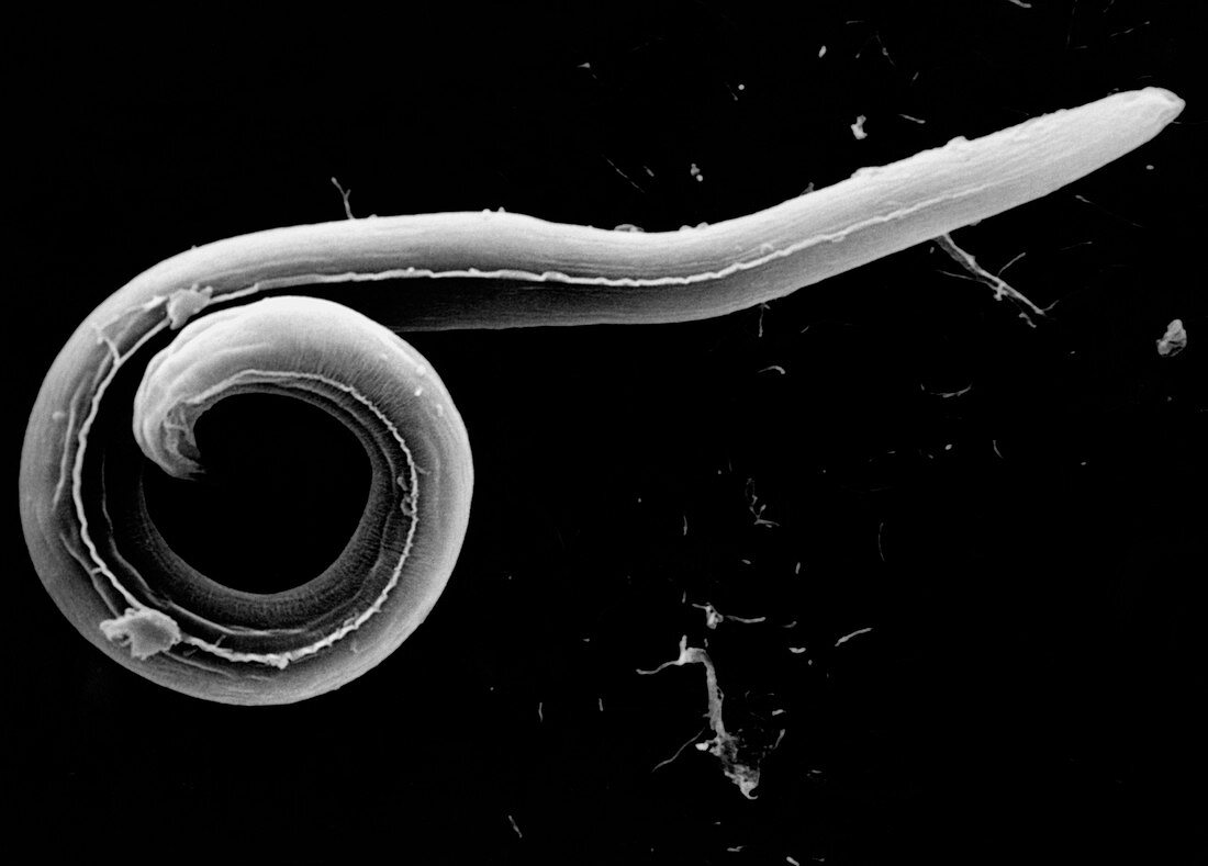 SEM of roundworm Toxocara canis